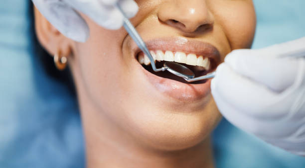Best Emergency Wisdom Teeth Removal in North Kansas City, MO